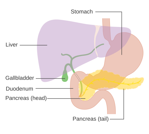 Pancreatic ductal adenocarcinoma